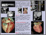 [thumbnail of 64 - MSCT Coronarography - Snap Shot Pulse Prospective Gated Protocol.jpg]