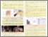 [thumbnail of Shoulder Bursitis Treatment with Acupuncture.pdf]