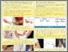[thumbnail of Tennis elbow treatment with acupuncture.pdf]