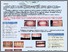 [thumbnail of Poster ortodoncija 1 %281%29.pdf]